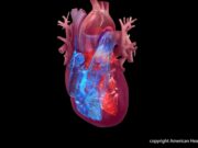 deaths from heart valve infections drop across u s overall but surged among young adults